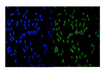 HDAC9 Rabbit Polyclonal Antibody