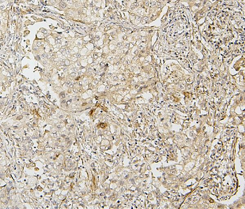 IRF3 Antibody