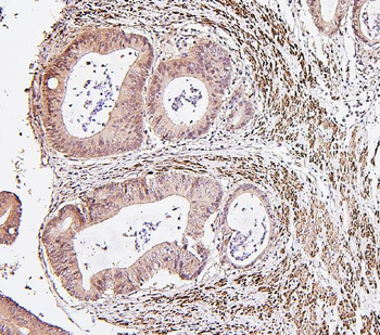 IRF3 Antibody