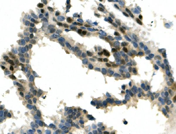 ITCH/AIP4 Antibody