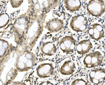 ITCH/AIP4 Antibody