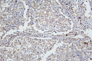 ApoER2/LRP8 Antibody