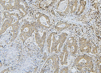 ApoER2/LRP8 Antibody