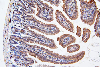 ApoER2/LRP8 Antibody