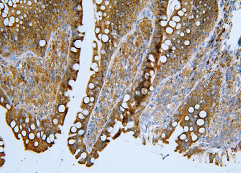 ApoER2/LRP8 Antibody
