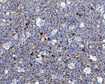 NOXA2/p67phox/NCF2 Antibody