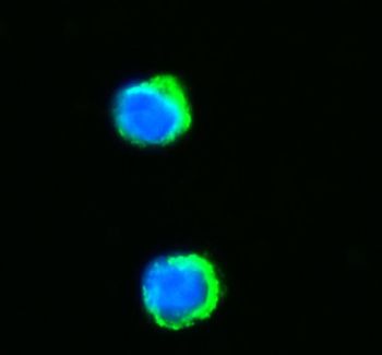 NNT Rabbit Polyclonal Antibody