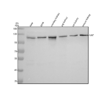 NNT Rabbit Polyclonal Antibody