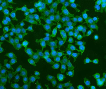 PDE6 alpha/PDE6A Rabbit Polyclonal Antibody