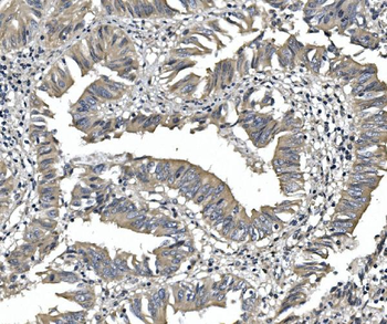 PDE6 alpha/PDE6A Rabbit Polyclonal Antibody