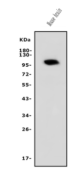 PDE10A Rabbit Polyclonal Antibody