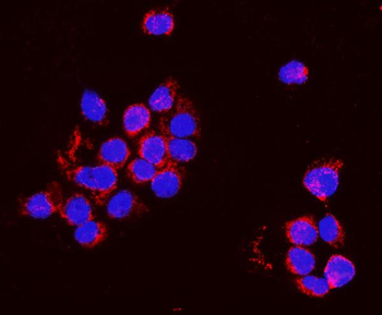 PNPT1 Rabbit Polyclonal Antibody