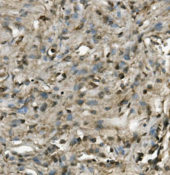 PRMT8 Rabbit Polyclonal Antibody