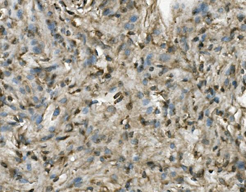 PRMT8 Rabbit Polyclonal Antibody