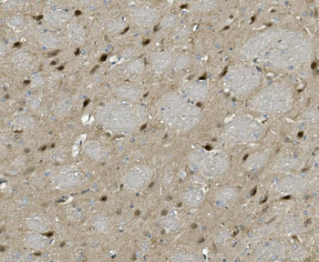 PRMT8 Rabbit Polyclonal Antibody