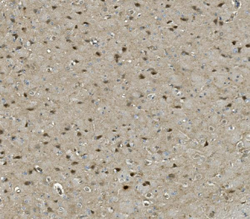 PRMT8 Rabbit Polyclonal Antibody