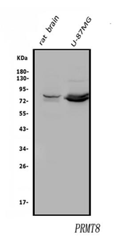 PRMT8 Rabbit Polyclonal Antibody
