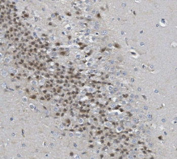 Rad9b Rabbit Polyclonal Antibody