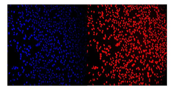RCC1 Antibody