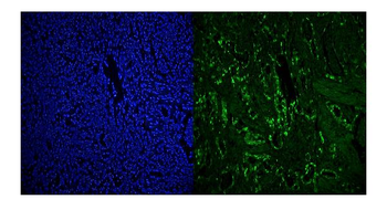 RCC1 Antibody