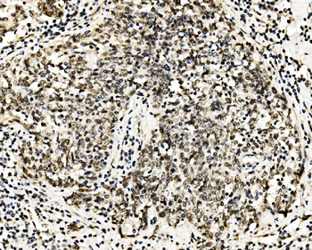 RCC1 Antibody
