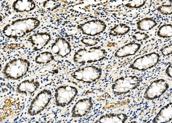 RCC1 Antibody