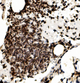 RCC1 Antibody