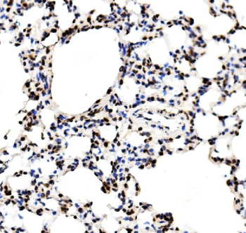 RCC1 Antibody