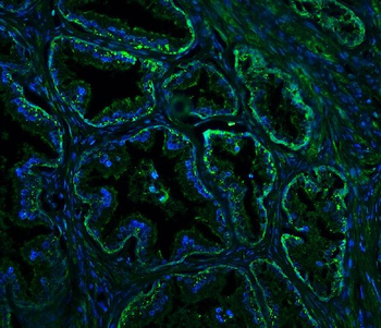 Nogo A/RTN4 Antibody