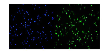 Transketolase/TKT Antibody