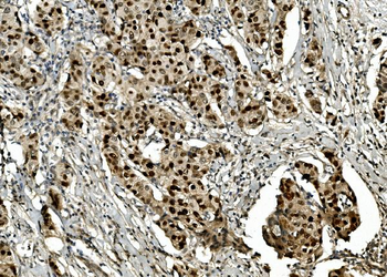 Transketolase/TKT Antibody