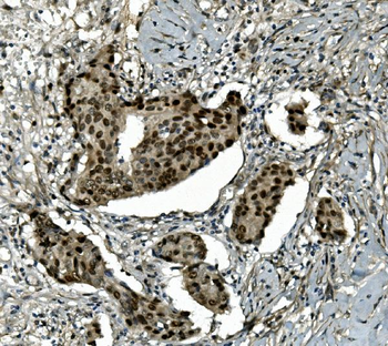 Transketolase/TKT Antibody