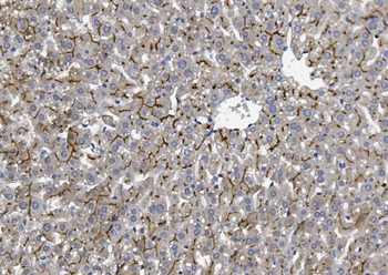 BCRP/ABCG2 Rabbit Polyclonal Antibody