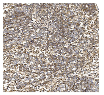BDH1 Antibody
