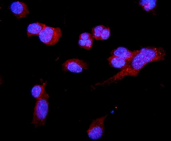 C5a-R/C5ar1 Antibody