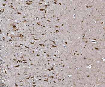CISD2 Rabbit Polyclonal Antibody