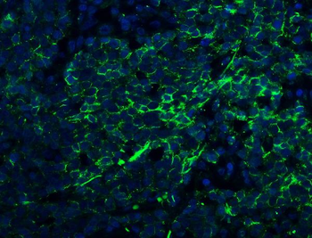 Claudin 1/CLDN1 Antibody