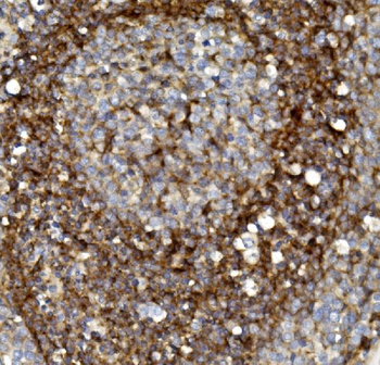 Claudin 1/CLDN1 Antibody