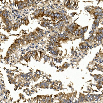 Claudin 1/CLDN1 Antibody