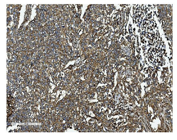 Clathrin heavy chain/CLTC Antibody