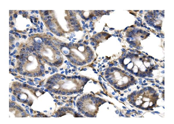 Clathrin heavy chain/CLTC Antibody