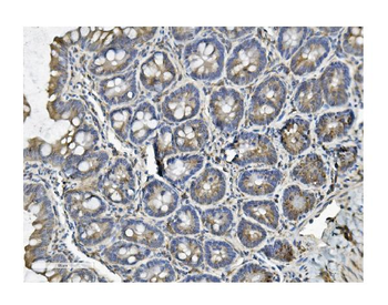 Clathrin heavy chain/CLTC Antibody