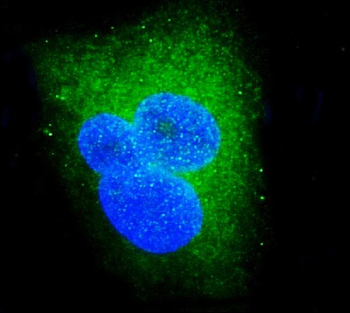 DDX6 Rabbit Polyclonal Antibody