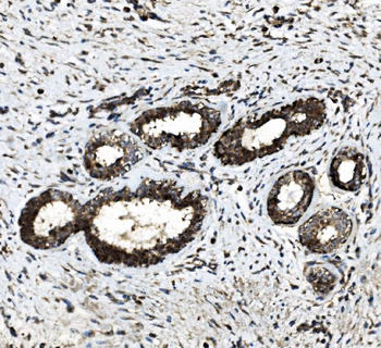 DDX6 Rabbit Polyclonal Antibody