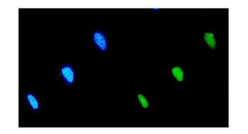 EIF2B1 Antibody