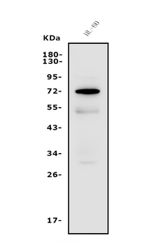 FUT4 Rabbit Polyclonal Antibody