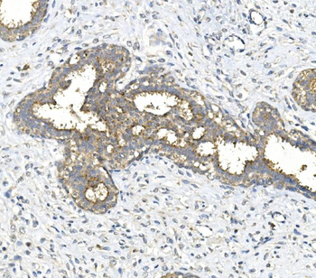 Galactosidase alpha/Gla Rabbit Polyclonal Antibody