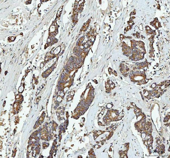 GRB10 Rabbit Polyclonal Antibody
