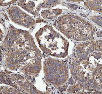 GRB10 Rabbit Polyclonal Antibody