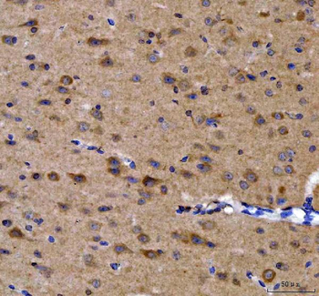 GRB10 Rabbit Polyclonal Antibody
